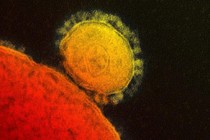 US confirms its first case of MERS virus