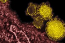 Saudi Arabia reports big jump in MERS cases, including 282 deaths