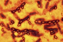 Anthrax risk for 75 scientists in US