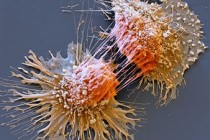 Cancer gene test 'would save lives'