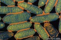 Portugal Legionnaires' disease outbreak kills five