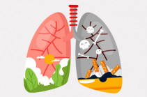 Ամեն տարի ավելի քան 8 մլն մարդ է մահանում ծխախոտի օգտագործման հետևանքով. Առանց ծխախոտի համաշխարհային օրն է