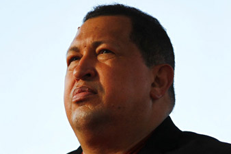 Hugo Chavez is in good physical condition after surgery