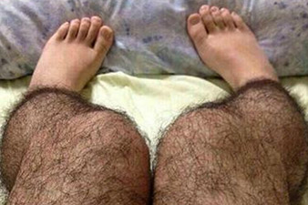 Hairy stockings aimed at deflecting unwanted male attention