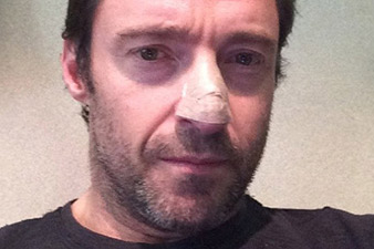 Hugh Jackman reveals treated for skin cancer