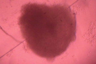 Mini-hearts grown to study disease