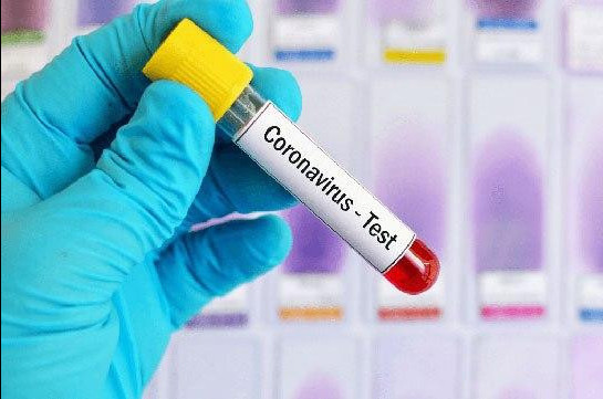 Three new confirmed coronavirus cases registered in Armenia, making total number of infected 26