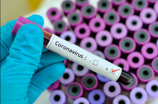 Artsakh coronavirus cases reach 3 after two other people test positive