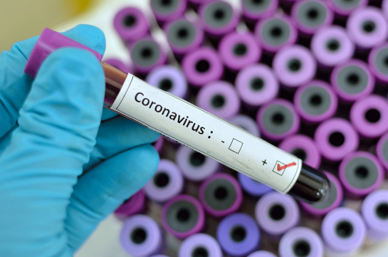 Two new confirmed coronavirus cases recorded in Artsakh