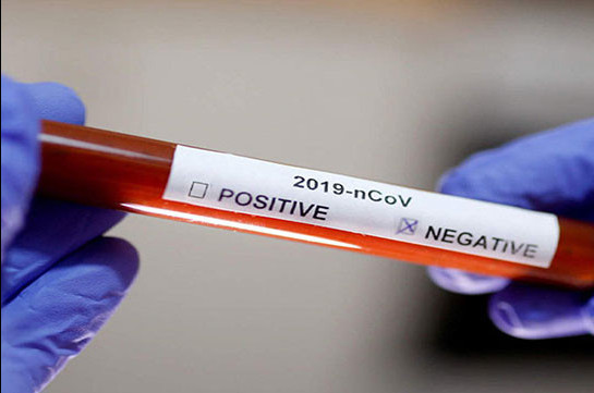 Covid-19 patient in Gegharkunik tests negative, third test to be conducted