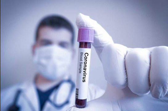 Deceased coronavirus patient, 73, had pneumonia and suffered from chronic diseases