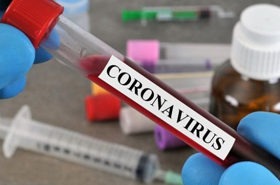 Number of coronavirus cases in Armenia’s Gegharkunik reaches 73