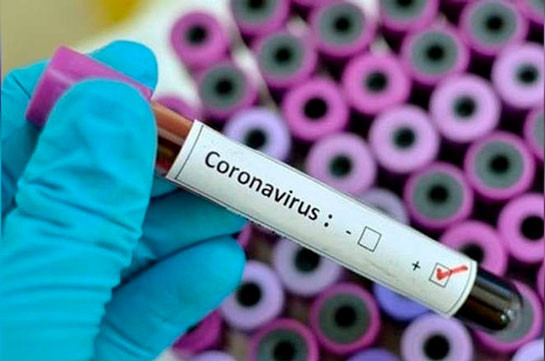 Number of coronavirus cases in Armenia reach 13,325, eleven new death cases reported