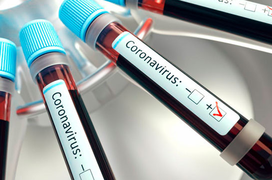 Coronavirus: Georgia Reports 2 New Cases, 2 Recoveries