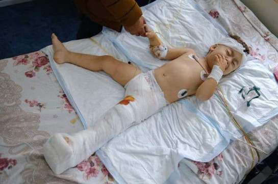 The face of Azerbaijani aggression: 2-year old child injured after heavy bombing in Karabakh’s Martuni