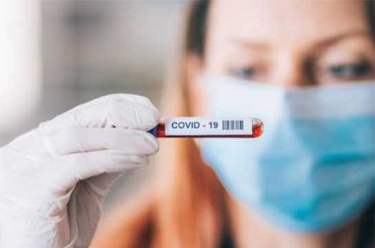 Число заражений COVID-19 в мире превысило 185,5 млн - университет Хопкинса