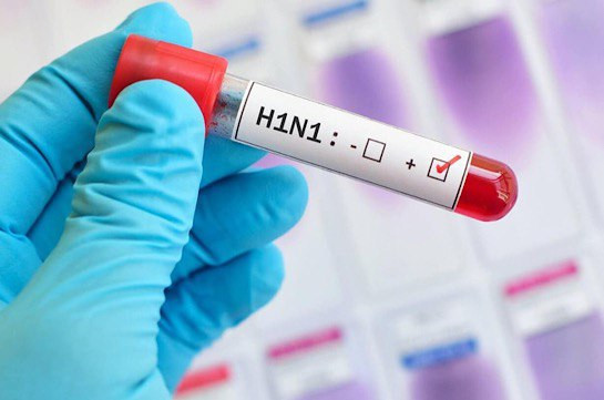 В Армении подтвержден возбудитель вируса гриппа типа А подтипа H1N1