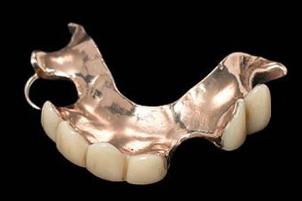 Churchill's false teeth sold at auction